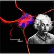 EINSTEIN Y LOS ASTROCITOS