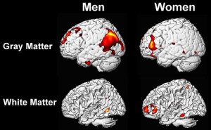 FELITIA estructura cerebral de hombre y mujer